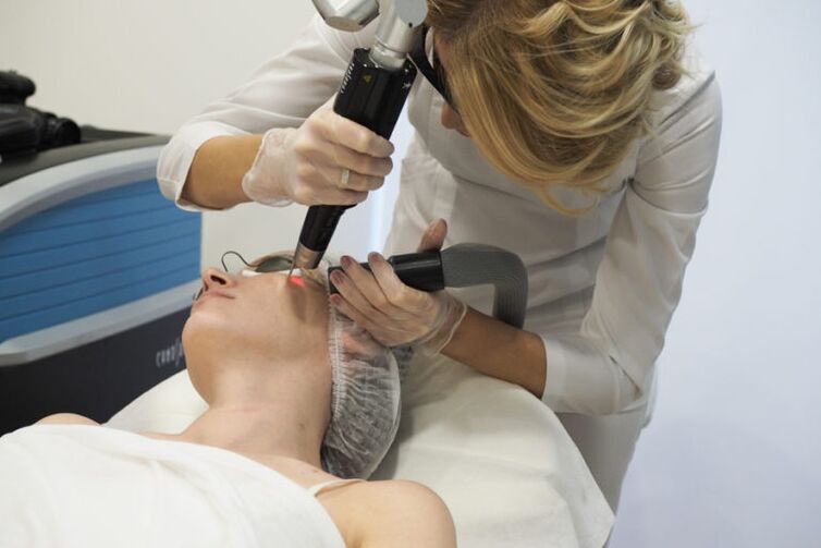 Laser skin rejuvenation procedure