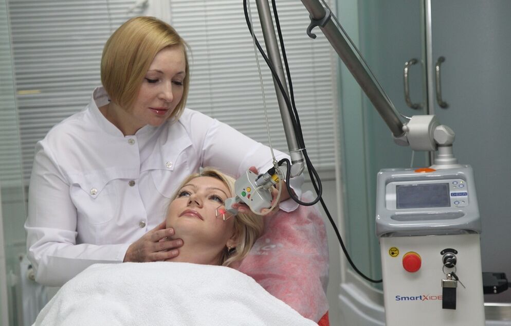 Fractional laser skin resurfacing procedure