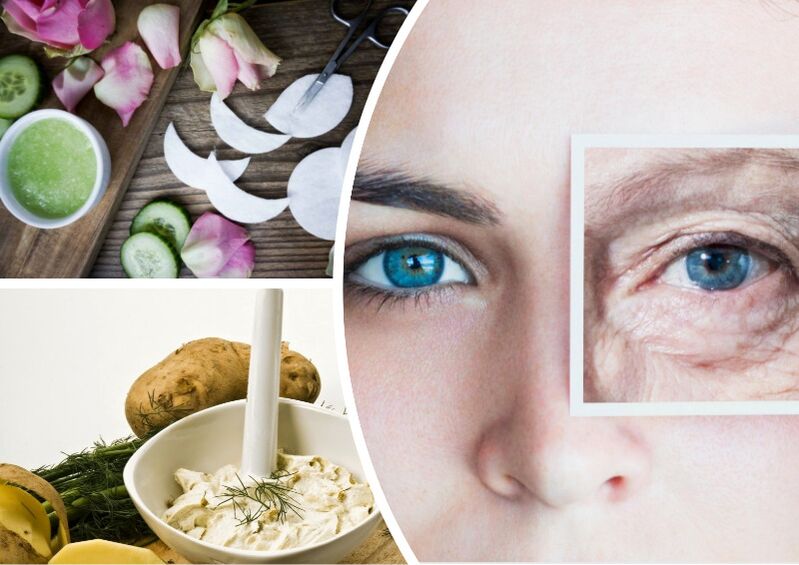 The direction of the skin around the eyes