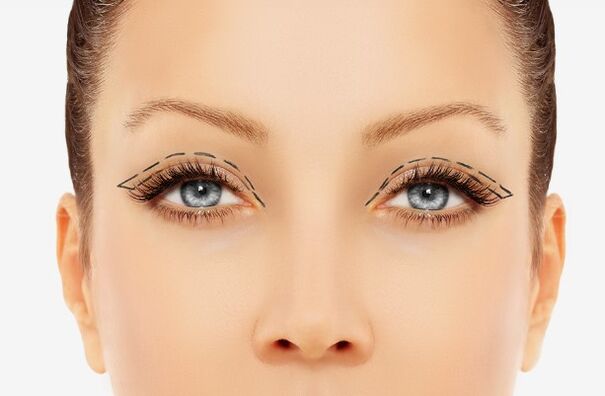 Eyelid