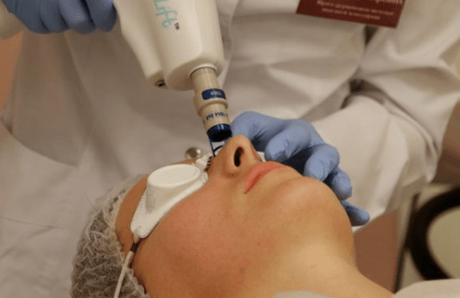Renewal of non -possible laser
